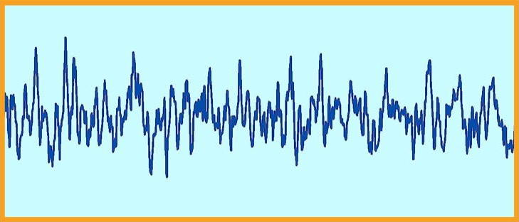 Audio Waveform
